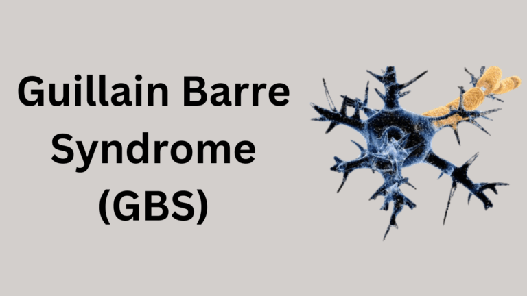 Guillain-Barre Syndrome (GBS)